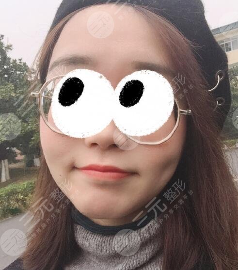 沈阳七院激光科太贵了？沈阳七院激光美容价目表2025来袭！