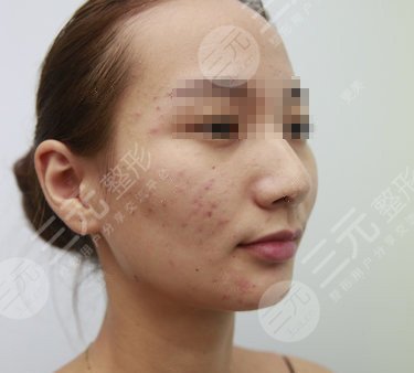 哈尔滨211美容科整形价目表来袭，仙女们请收下！