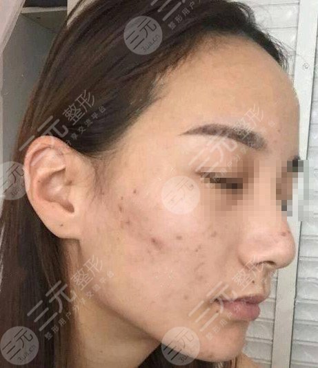 哈尔滨211美容科整形价目表来袭，仙女们请收下！