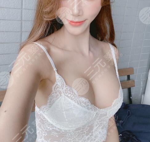 自体脂肪隆胸果