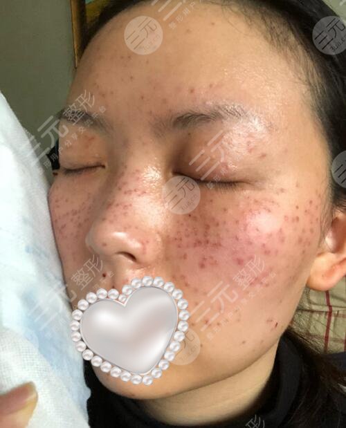 东莞康华医院整形案例
