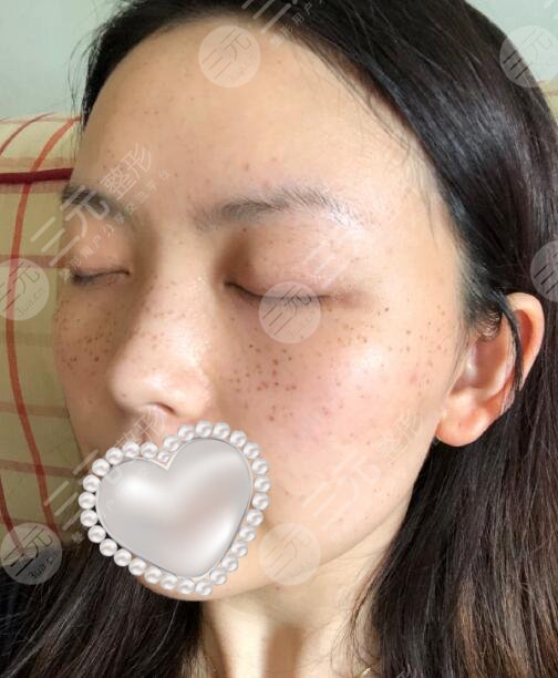 东莞康华医院整形案例
