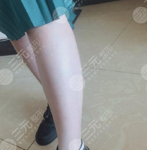 玉林市第一人民医院激光美容价目表，激光脱毛远离毛绒绒！医生|案例