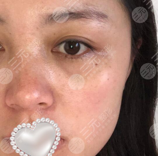 上海九院激光美容价目表