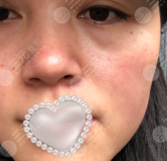 上海九院激光美容价目表