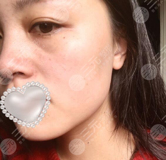 上海九院激光美容价目表