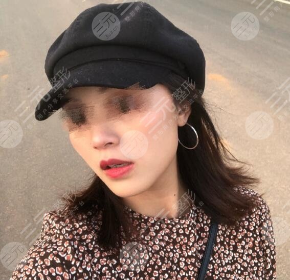 上海九院激光美容价目表