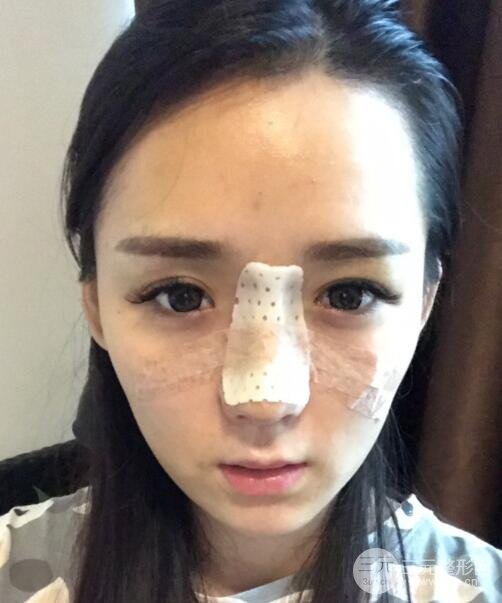 广州姬妍医学美容整形医院案例分享