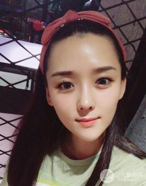 广州姬妍医学美容整形医院案例分享