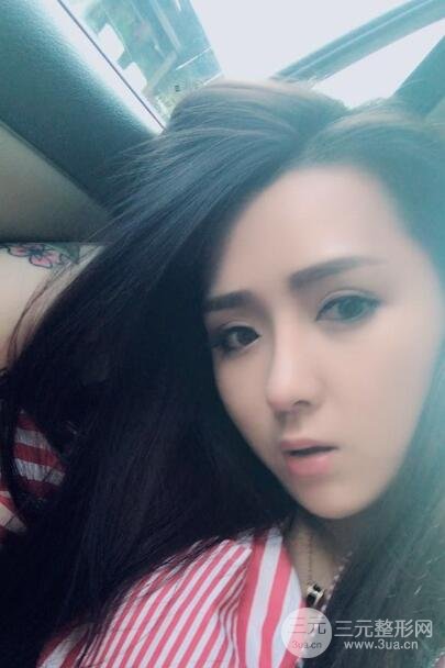 广州姬妍医学美容整形医院案例分享