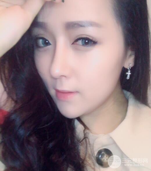 广州姬妍医学美容整形医院案例分享