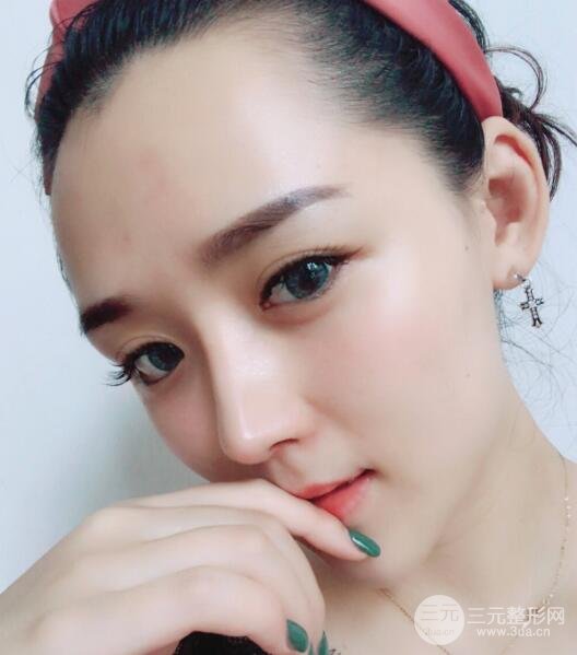 广州姬妍医学美容整形医院案例分享