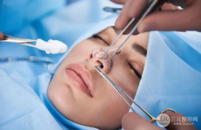 隆鼻整形的恢复过程