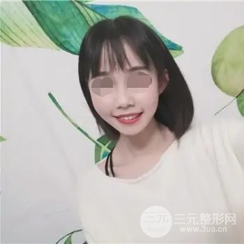 了解上海九院烤瓷牙价目表,轻松做烤瓷牙