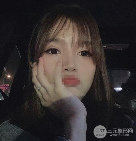 整形案例