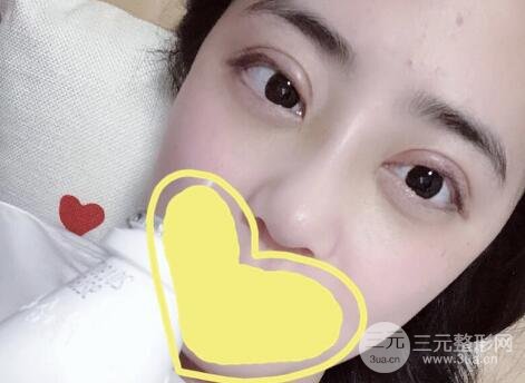 整形案例