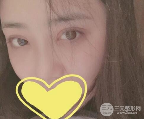 整形案例