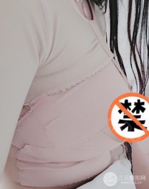 自体脂肪丰胸手术案例