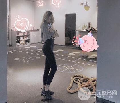 抽脂案例欣赏