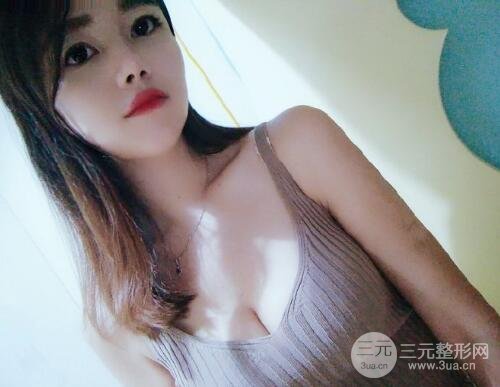 自体脂肪填充乳房
