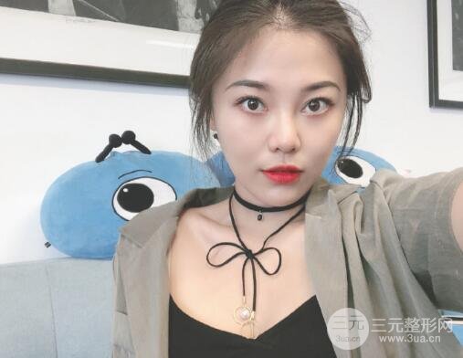 面部拉皮除皱