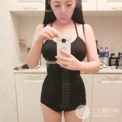 水动力腰腹环吸脂