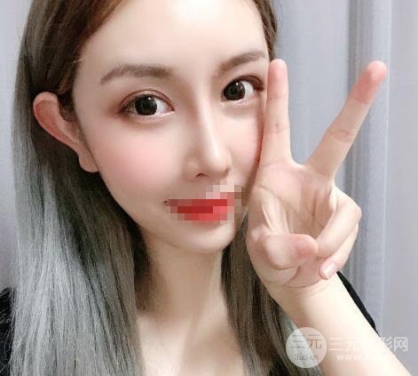 鼻部综合整形