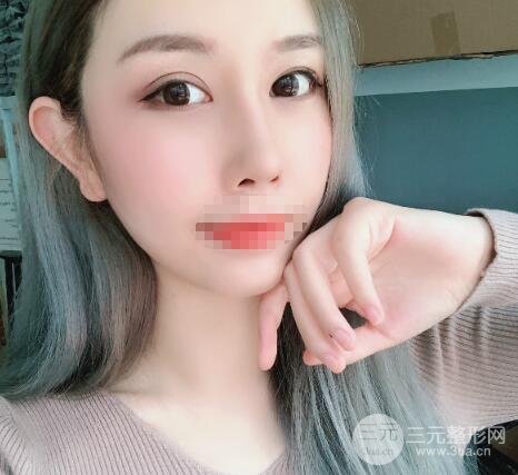 鼻部综合整形