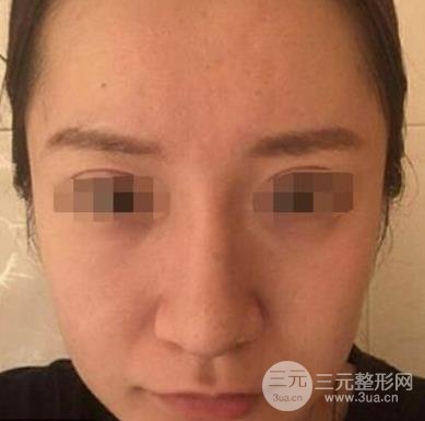 浙一医院整形美容科价目表更新，附医生名单&案例！