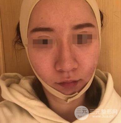浙一医院整形美容科价目表更新，附医生名单&案例！