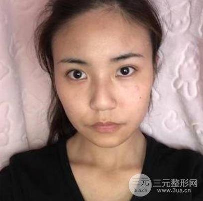 浙一医院整形美容科价目表更新，附医生名单&案例！