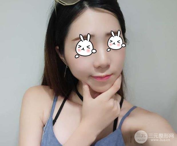 徐州二院整形科价格表更新&医生名单&隆鼻案例~