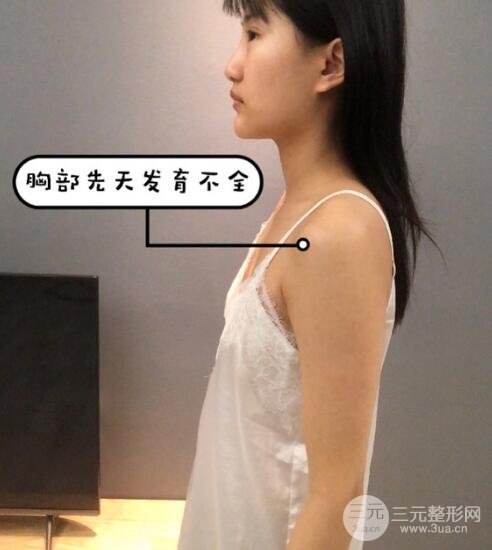 案例1