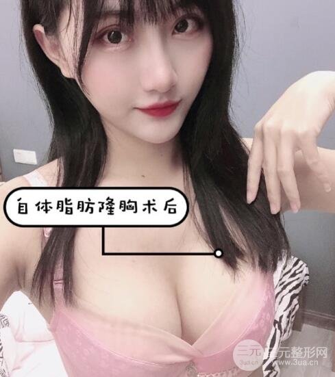 案例1