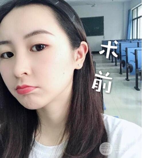 案例2