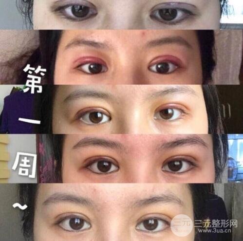 案例2