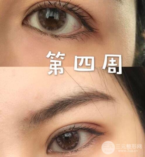 术后恢复