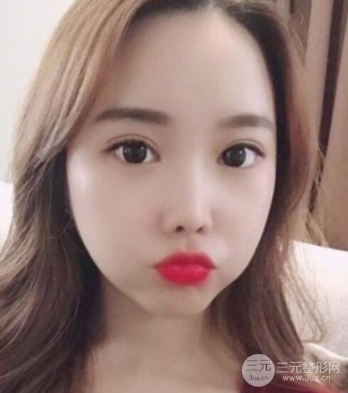 案例2