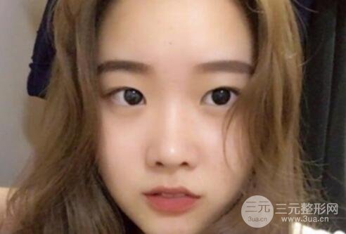 案例2