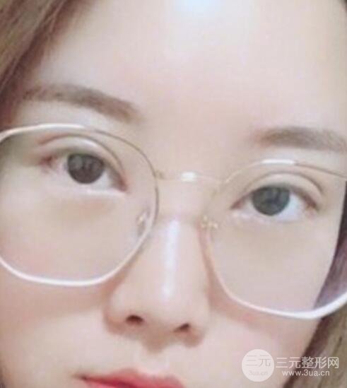 案例2