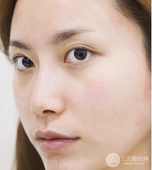 案例1