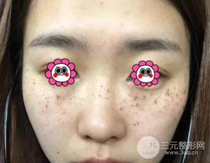 案例2