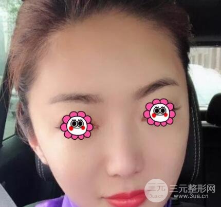 案例2