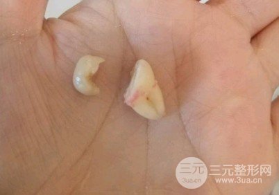 吉大口腔医院收费标准