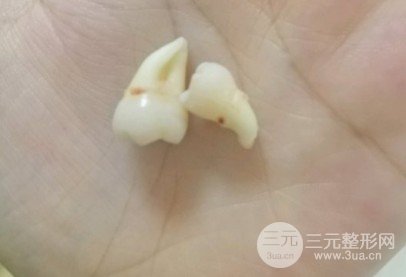 吉大口腔医院收费标准