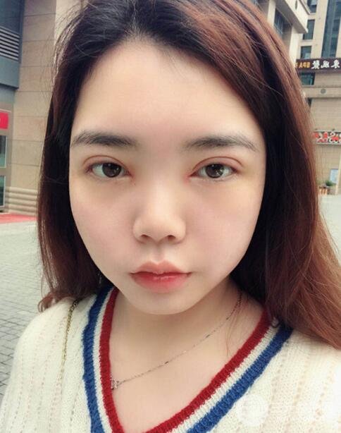 案例分享