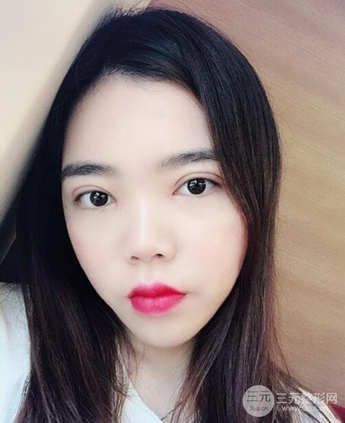 案例分享