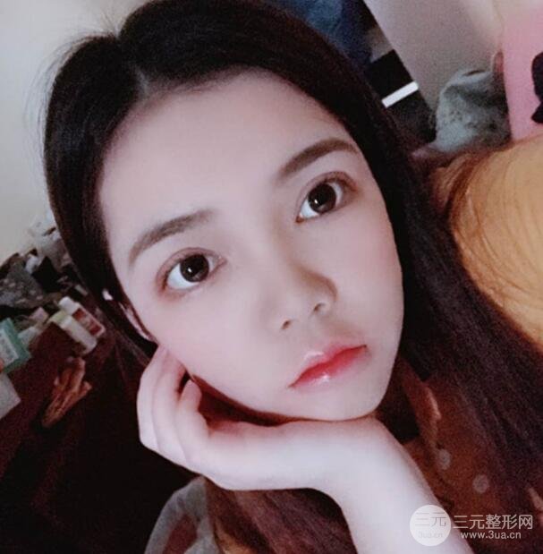 案例分享