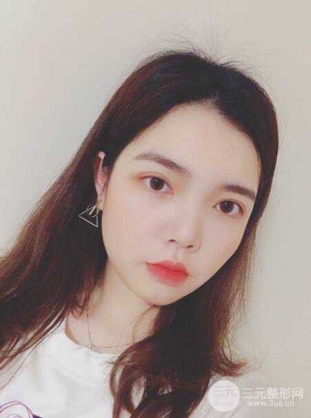 案例分享