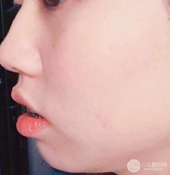 案例1